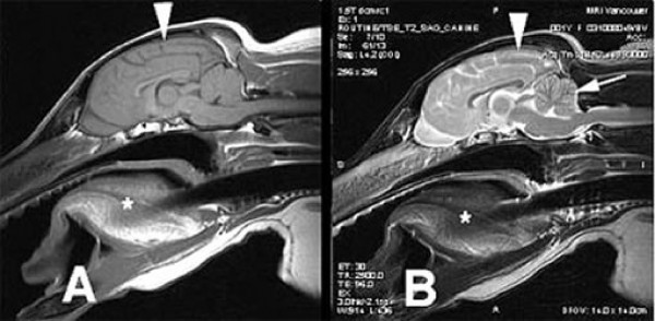 IRM d'un chien atteint d'épilepsie. A: Cette image montre le liquide céphalorachidien qui cirxule dans le cerveau en couleur sombre. B: Cette image montre le liquide céphalorachidien en blanc. La différence se remarque au niveau du cervelet, indiqué par la flèche.